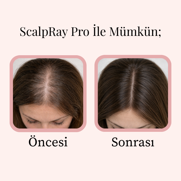 ScalpRay Pro - Saç Bakım Tarağı